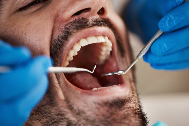 Best Emergency Treatment for Jaw Pain or Injury in Ellensburg, WA